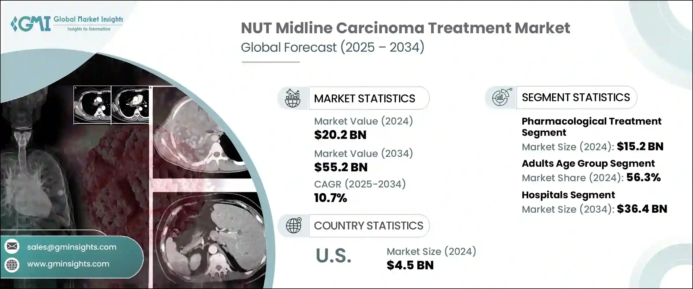 NUT 中線癌治療市場 - IMG1