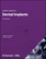 Dental Implants | Medtech 360 | Market Insights | North America