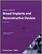 Breast Implants and Reconstructive Devices | Medtech 360 | Market Insights | United States