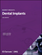 Dental Implants | Medtech 360 | Market Insights | Latin America