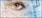 KOL Insight - Wet Age-related Macular Degeneration