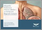 Idiopathic Pulmonary Fibrosis Market - A Global and Regional Analysis: Focus on Country and Region - Analysis and Forecast, 2025-2035