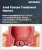 Anal Fissure Treatment Market Size, Share, and Growth Analysis, By Treatment Types (Topical Nitroglycerin, Calcium channel Blockers), By Application (Clinics, Hospitals), By Route of Administration, By Region -Industry Forecast 2026-2033.