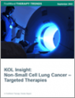 非小細胞肺癌的標靶治療市場:KOL的洞察