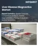 肝病診斷市場規模、佔有率和成長分析：按產品類型、疾病類型、技術、最終用戶、應用、分銷管道和地區分類—2026-2033年行業預測